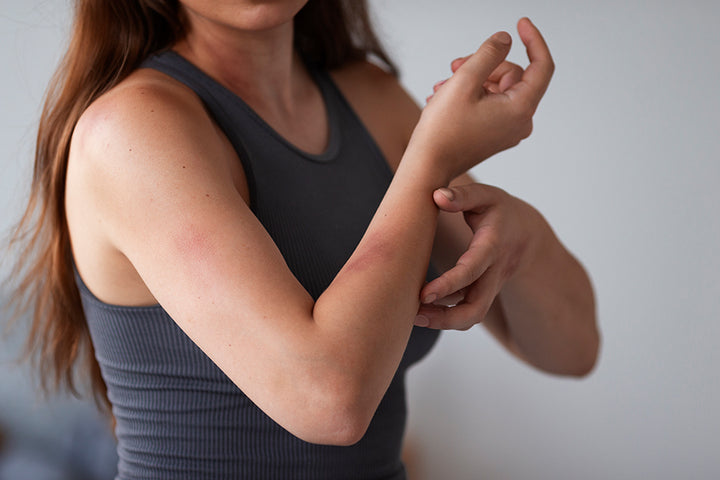 Getting Rid Of Rash How to get Rid of a Rash Overnight