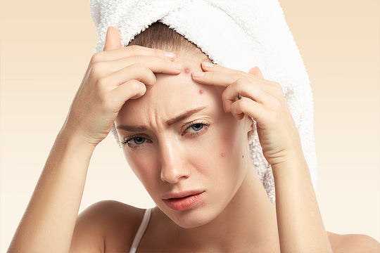 how to get rid of forehead acne